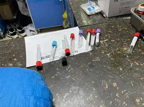 哪个季节进行冻胚移植成功率更高？